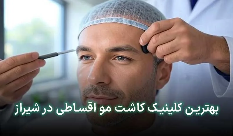 5 تا از بهترین کلینیک کاشت مو اقساطی در شیراز | آدرس + تلفن تماس