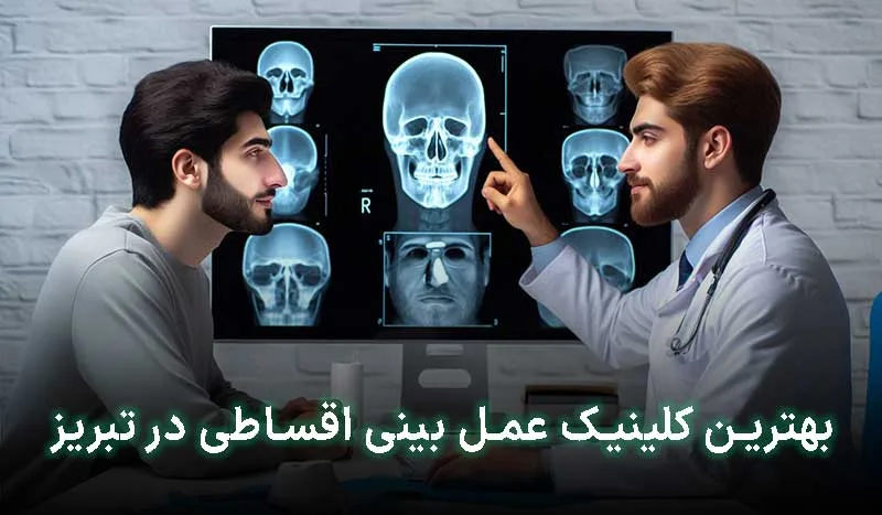 5 تا از بهترین کلینیک عمل بینی اقساطی در تبریز + آدرس، تلفن