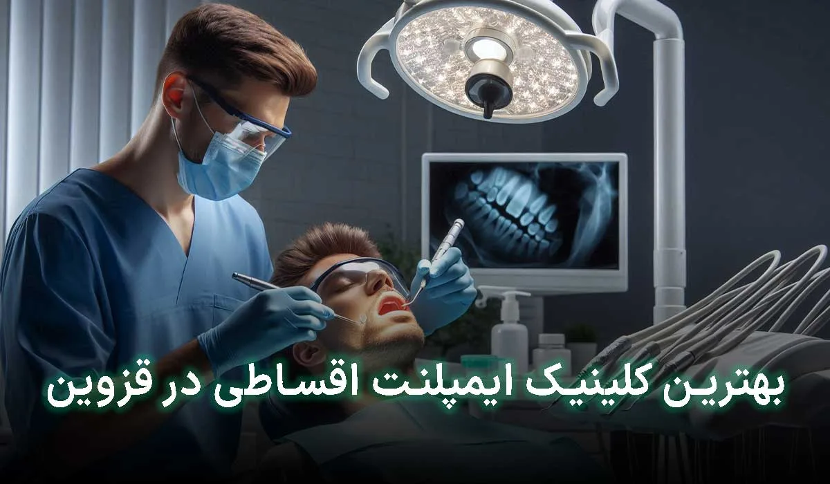 5 تا از بهترین کلینیک ایمپلنت اقساطی در قزوین | آدرس + تلفن تماس