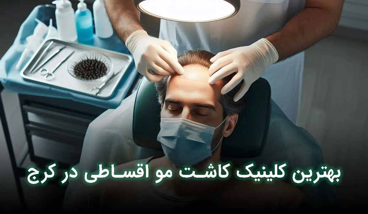 4 تا از بهترین مرکز کاشت مو اقساطی کرج + آدرس، تلفن