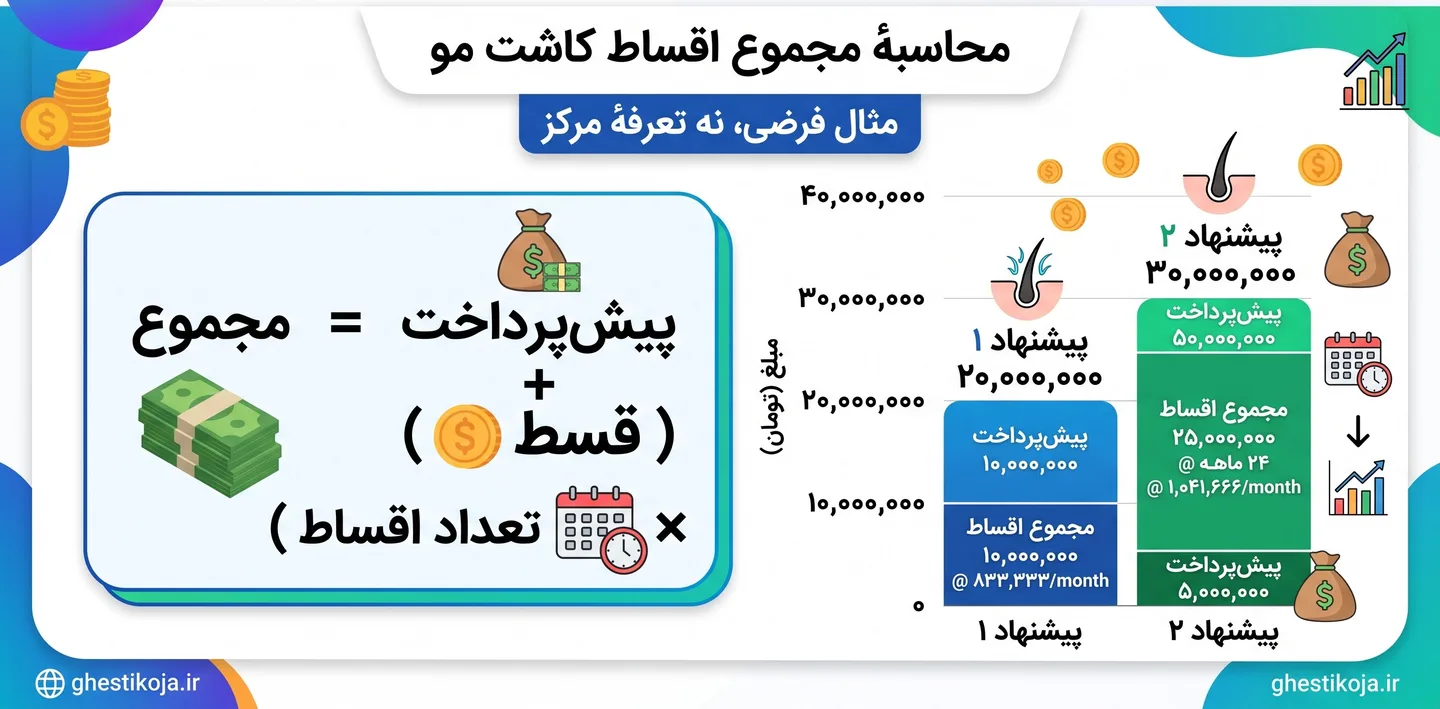 کاشت موی اقساطی در ایران؛ پیشپرداخت، اقساط و هزینههای درمان