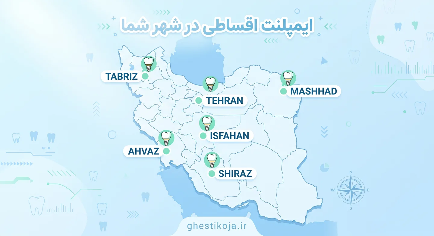 ایمپلنت دندان اقساطی؛ معرفی مراکز و شرایط پرداخت
