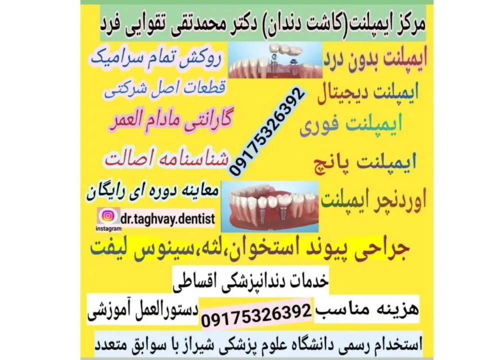 دندانپزشکی ایمپلنت دکتر تقوایی فرد